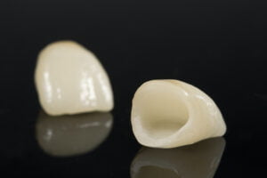 Ceramic Crowns and Woombye Dentistry