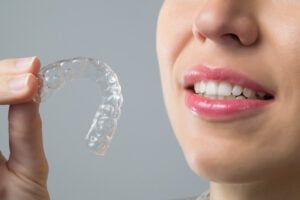 Easy to use Orthodontic Retainers