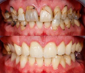 Cosmetic Dentistry