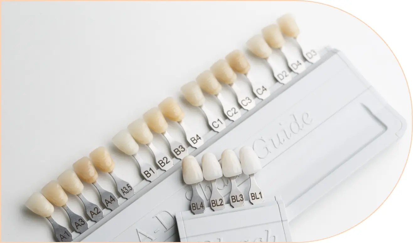 Ceramic Veneers hinterland view