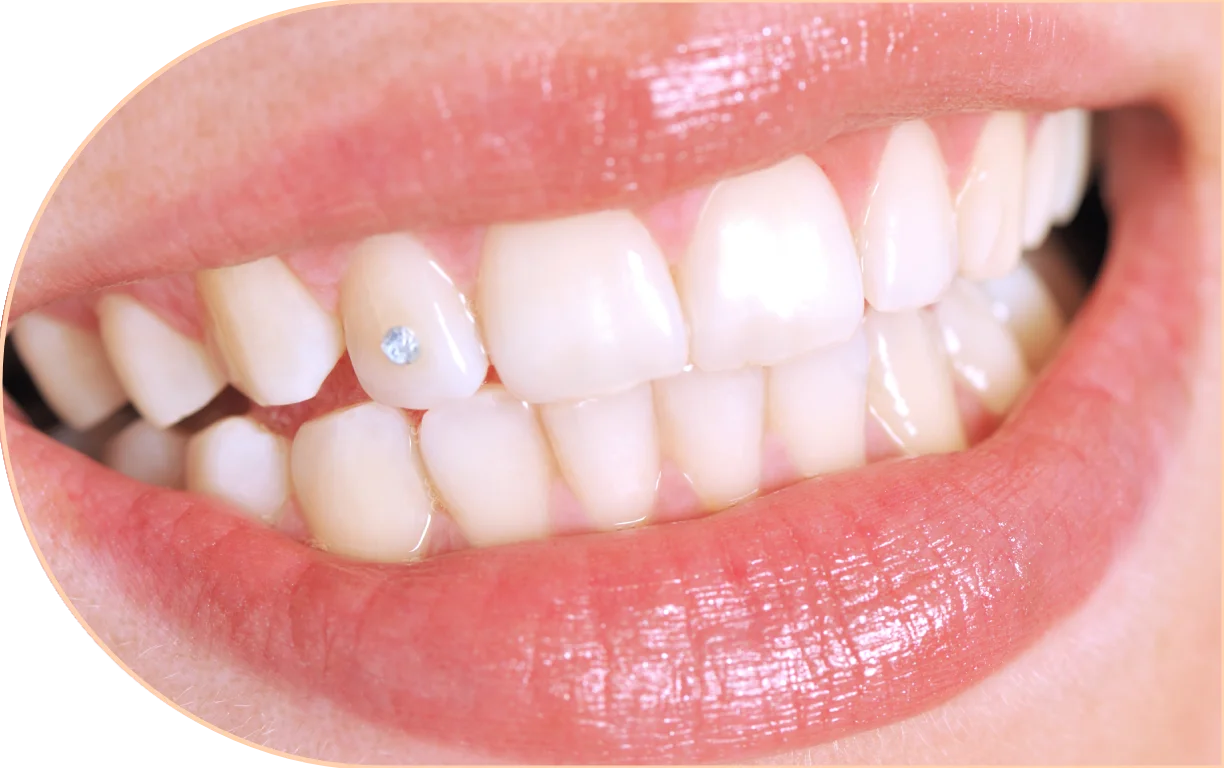 Sparkle and shine with something unique