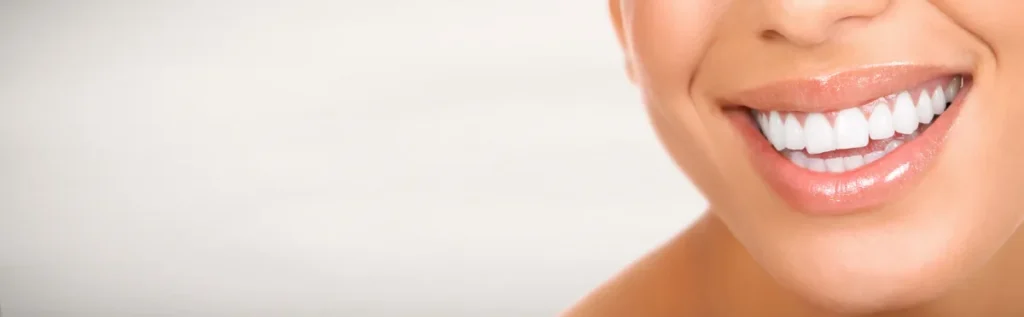 Teeth Whitening Hinterland