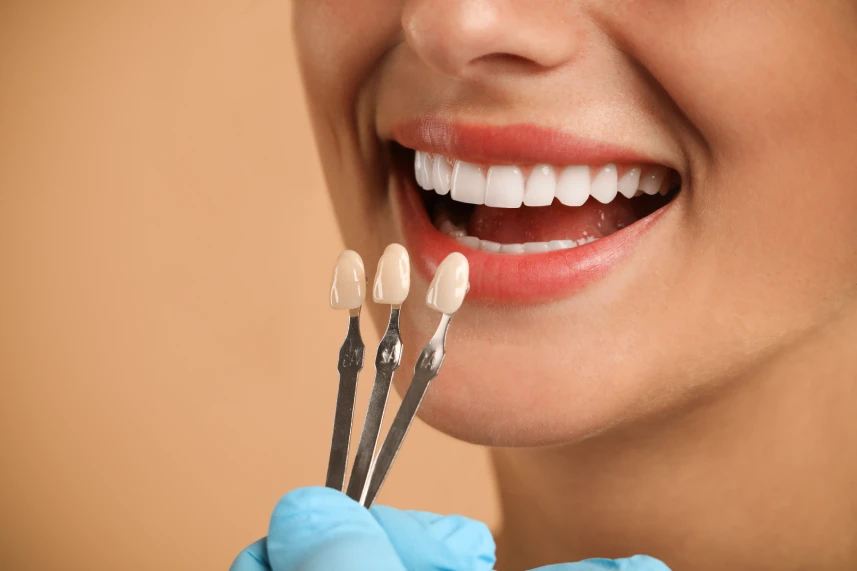 Veneers Hinterland View dental