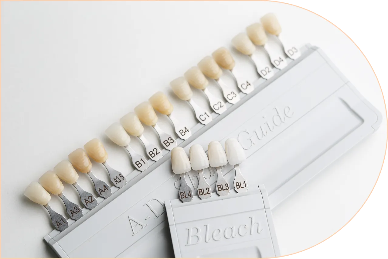 Ceramic Veneers Hinterland View