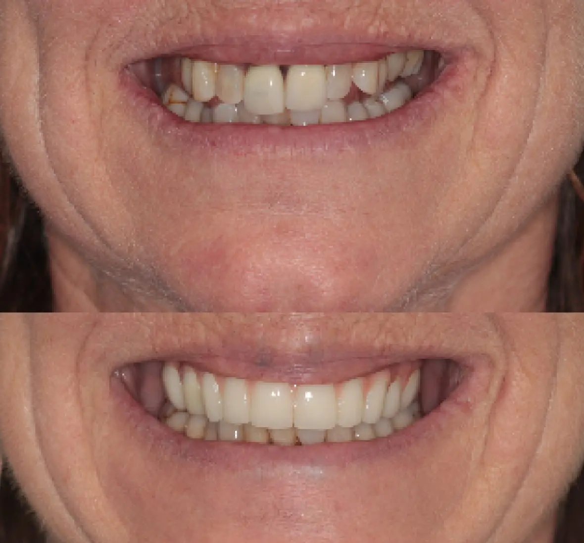 Real Patients Real Result Female Case 2