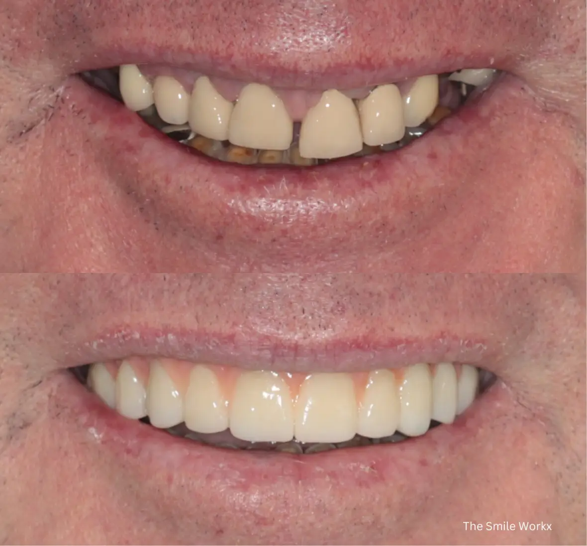 Real Patients Real Result Male Case 1